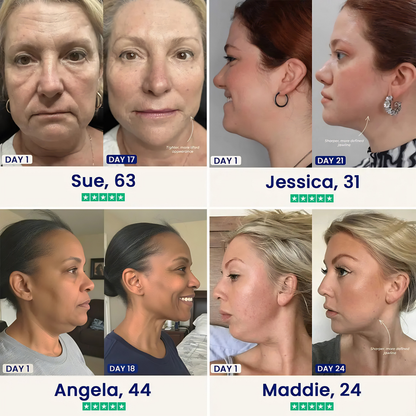 Retinol Chin Lifting Mask